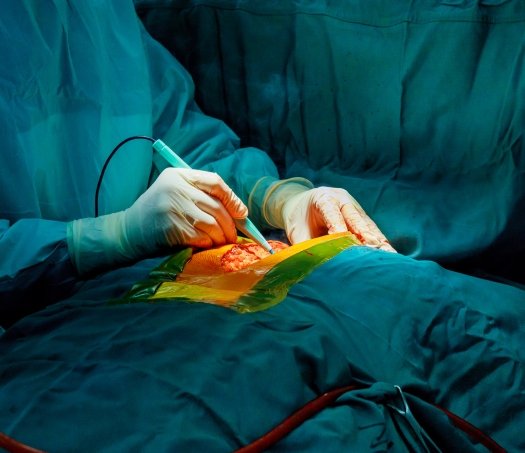 Orthopedic Surgery Trinity Hospitals
